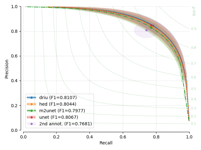 Model comparisons for chasedb1 datasets