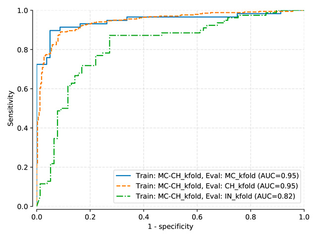 Testing sets ROC curves for DenseNet model trained on normalized-kfold MC-CH