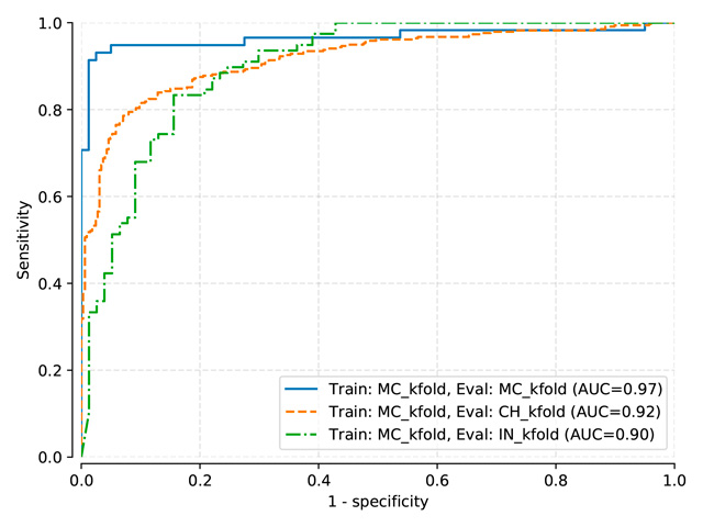 Testing sets ROC curves for DenseNet model trained on normalized-kfold MC (pretrained on NIH)