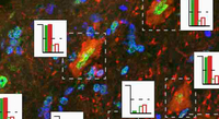 The first paper in Brain Pathology