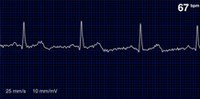 Analyser les signaux biologiques grâce à l’intelligence artificielle